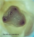 endodoncia-3